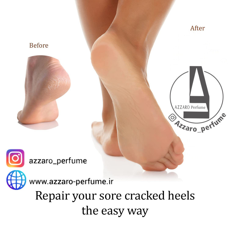 سوهان پا دو طرفه چوبی لوپینا lopina آلمان-فروشگاه اینترنتی آرایشی بهداشتی آزارو 