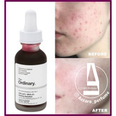 سرم پیلینگ اوردینری اصلی و اورجینال لایه بردار قوی حجم 30 میل-نمایندگی محصولات اوردینری اصلی و اورجینال_فروشگاه اینترنتی آرایشی بهداشتی آزارو