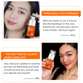 سرم کوچک کننده منافذ ویبرانت گلامور 30 میلی لیتر_فروشگاه اینترنتی آرایشی بهداشتی آزارو در شیراز