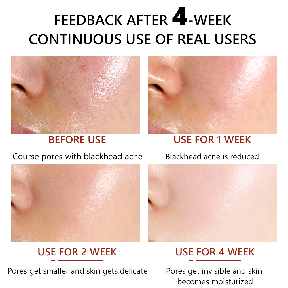 سرم کوچک کننده منافذ ویبرانت گلامور 30 میلی لیتر_فروشگاه اینترنتی آرایشی بهداشتی آزارو در شیراز