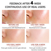 سرم کوچک کننده منافذ ویبرانت گلامور 30 میلی لیتر_فروشگاه اینترنتی آرایشی بهداشتی آزارو در شیراز