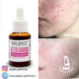 سرم پیلینگ و لایه بردار بالانس AHA10% و BHA2% حجم 30 میل-فروشگاه اینترنتی آرایشی و بهداشتی آزارو در شیراز