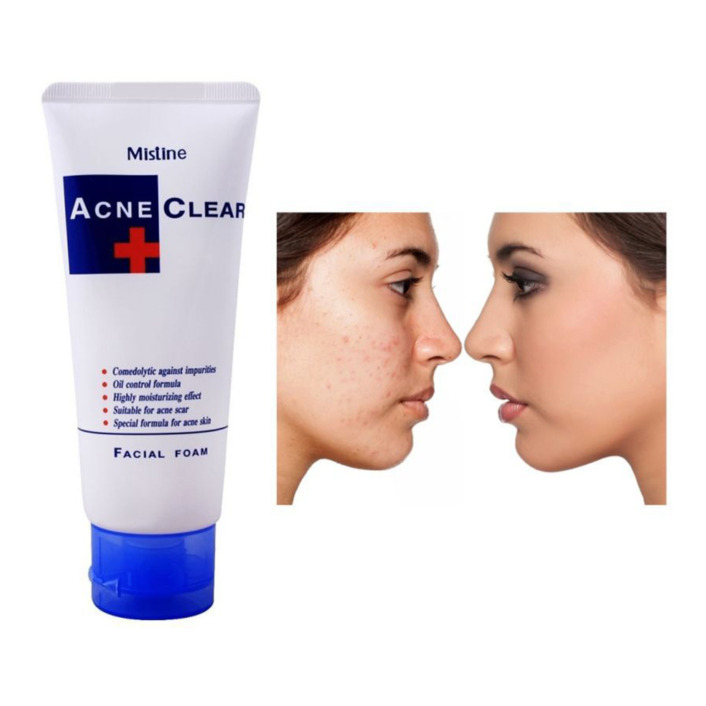 فوم شستشوی صورت و ضد آکنه میستین ACNE CLEAR (آکنه کلیر) حجم 85 گرم-فروشگاه آرایشی و بهداشتی آزارو در شیراز