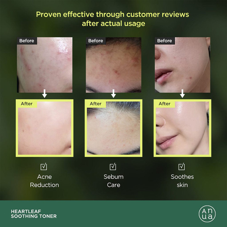 تونر تسکین دهنده آنوا ANUA Heartleaf 77% Soothing Toner حجم 250 میل-فروشگاه آرایشی و بهداشتی آزارو در شیراز