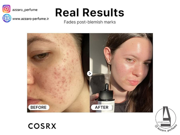 سرم نیاسینامید 15 کوزارکس COSRX ضد لک،روشن کننده پوست حجم 20 میل-فروشگاه اینترنتی آرایشی و بهداشتی آزارو در شیراز